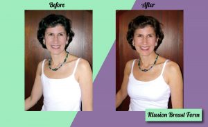 Illusion Breast Form before and after